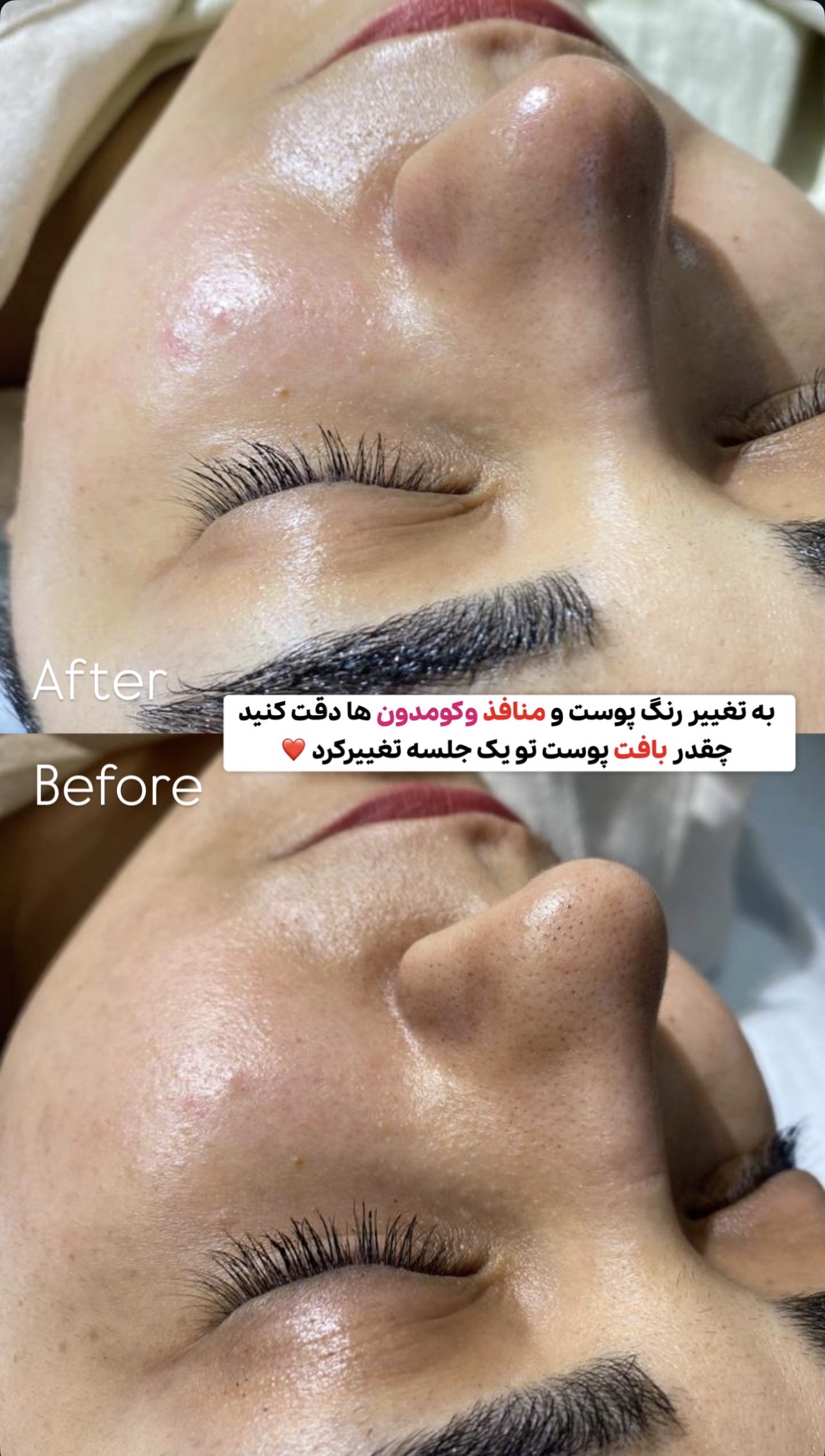 Skincare _eliamini