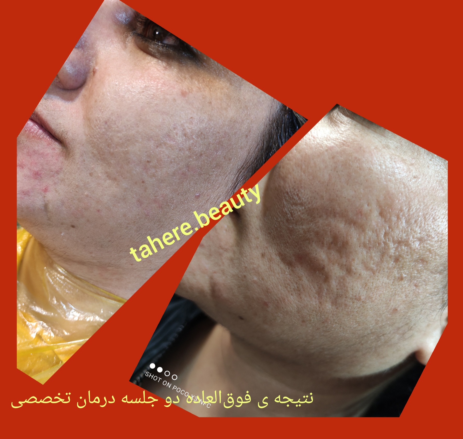 فیشال تخصصی طاهره بیوتی