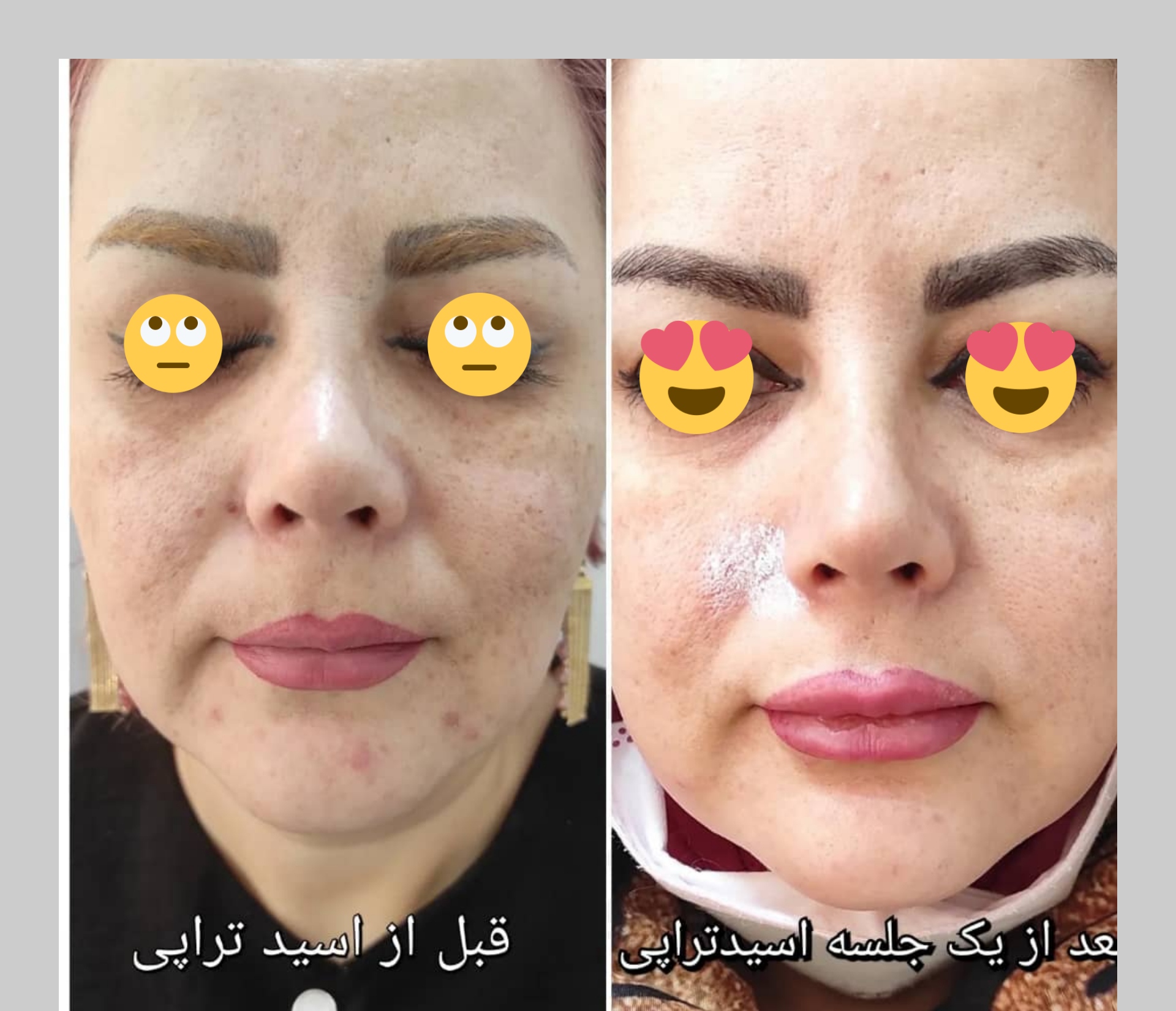 فیشال تخصصی طاهره بیوتی