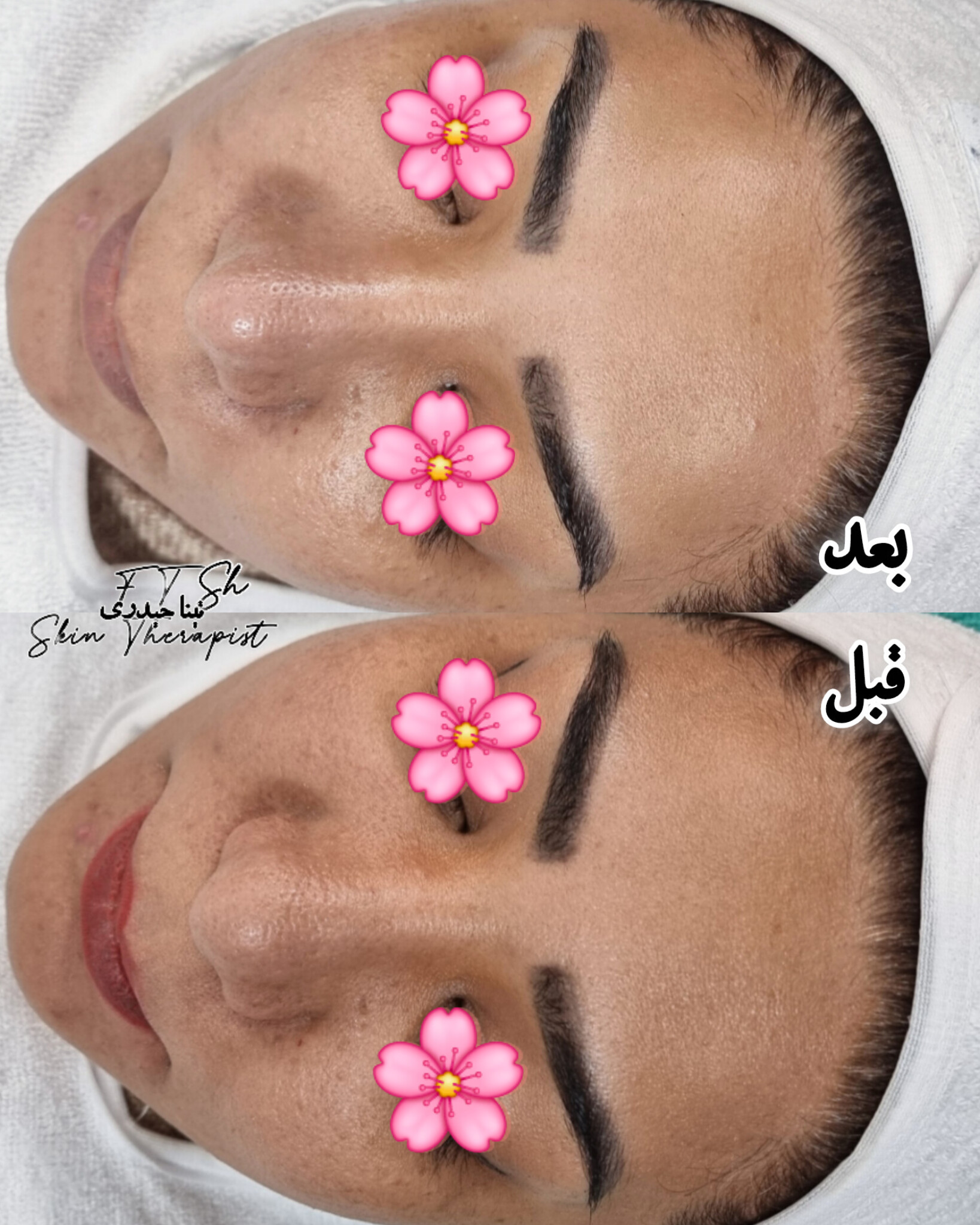 مرکز تخصصی فیشال و پاکسازی پوست تینا