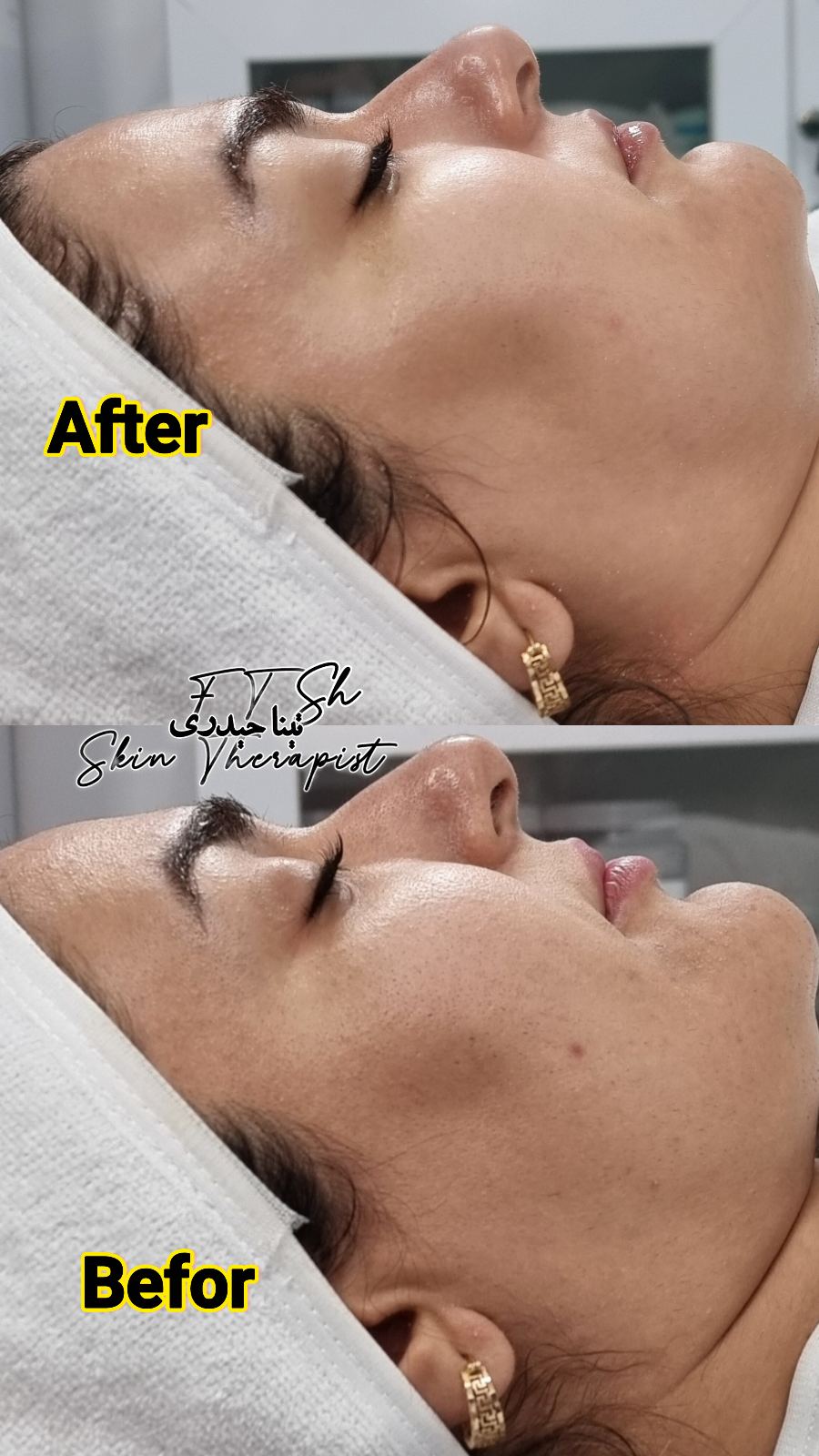 مرکز تخصصی فیشال و پاکسازی پوست تینا
