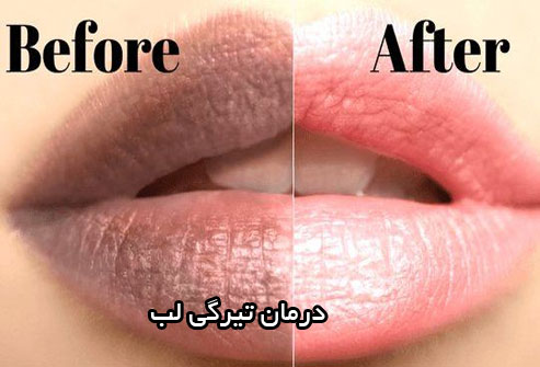 ارائه و خدمات آرایش دائم عرجی