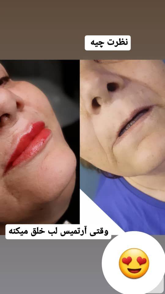 کلینیک پوست و مو و لیزر  و لاغری آرتمیس