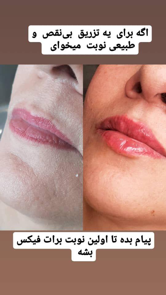 کلینیک پوست و مو و لیزر  و لاغری آرتمیس