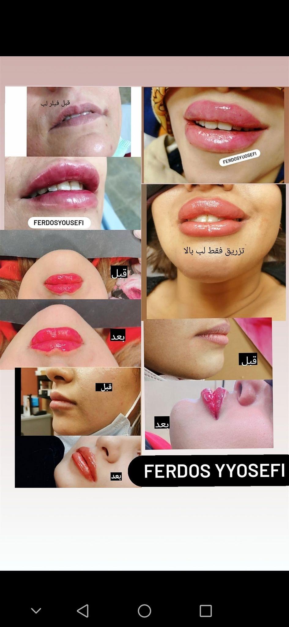 آیروس بیوتی