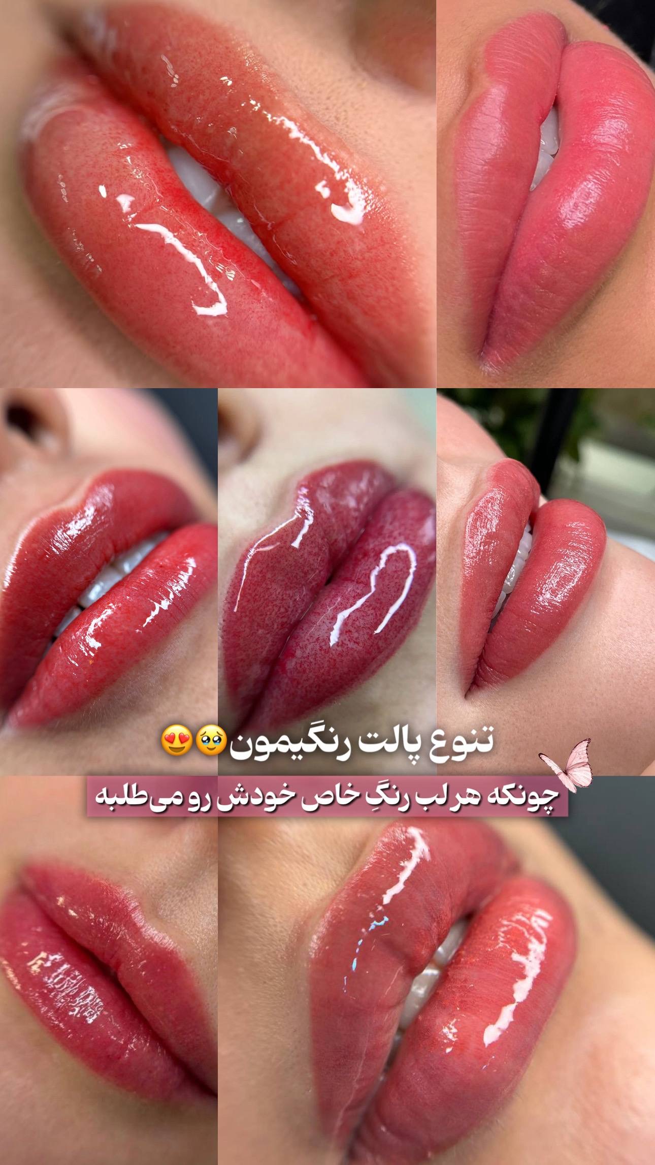 مرکز تخصصی شیدینگ لب بدون درد در قم