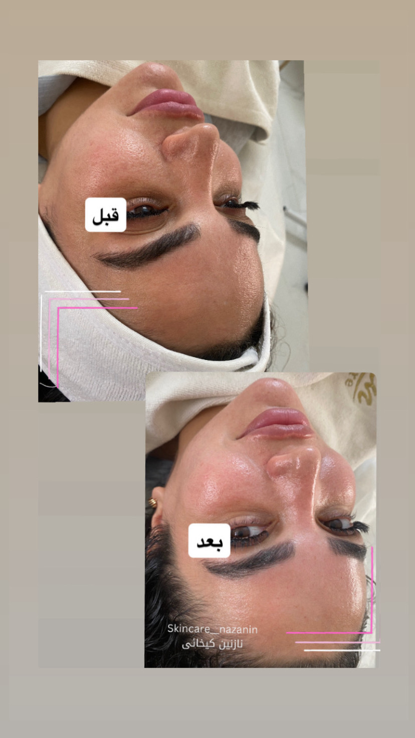 مرکز پاکسازی پوست نازنین کیخانی