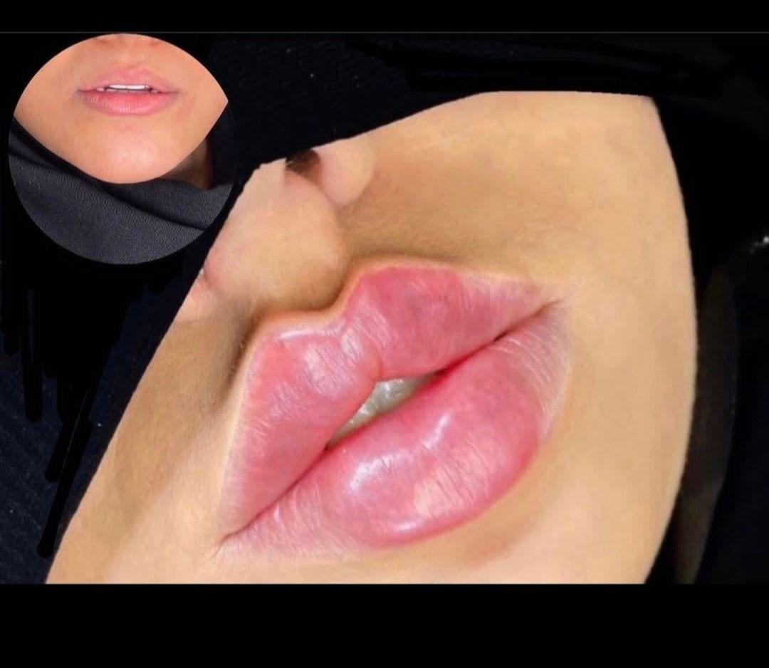 کلینیک لیزر و زیبایی نیوشا