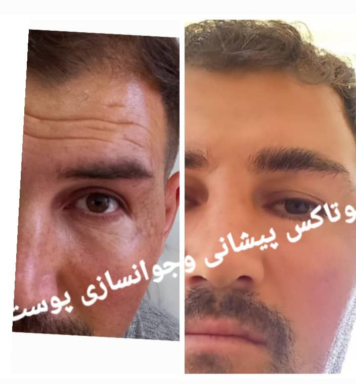 سالن هانی گل