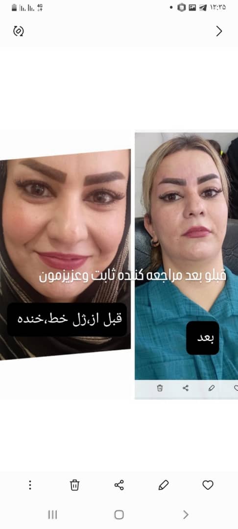 سالن هانی گل